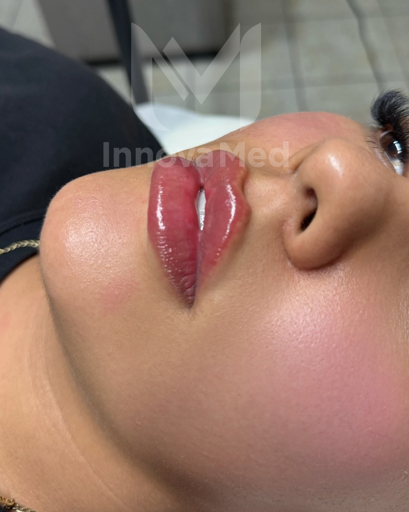 InnovaMed Facebook ad: Labios más hidratados, definidos y naturales