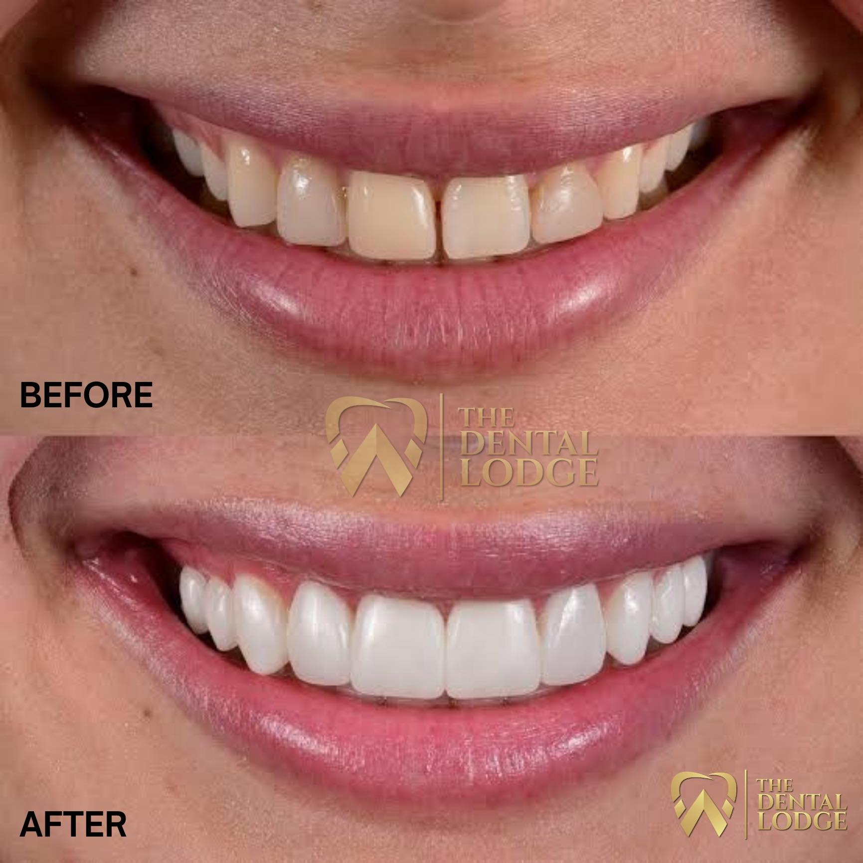 The Dental Lodge Facebook ad
