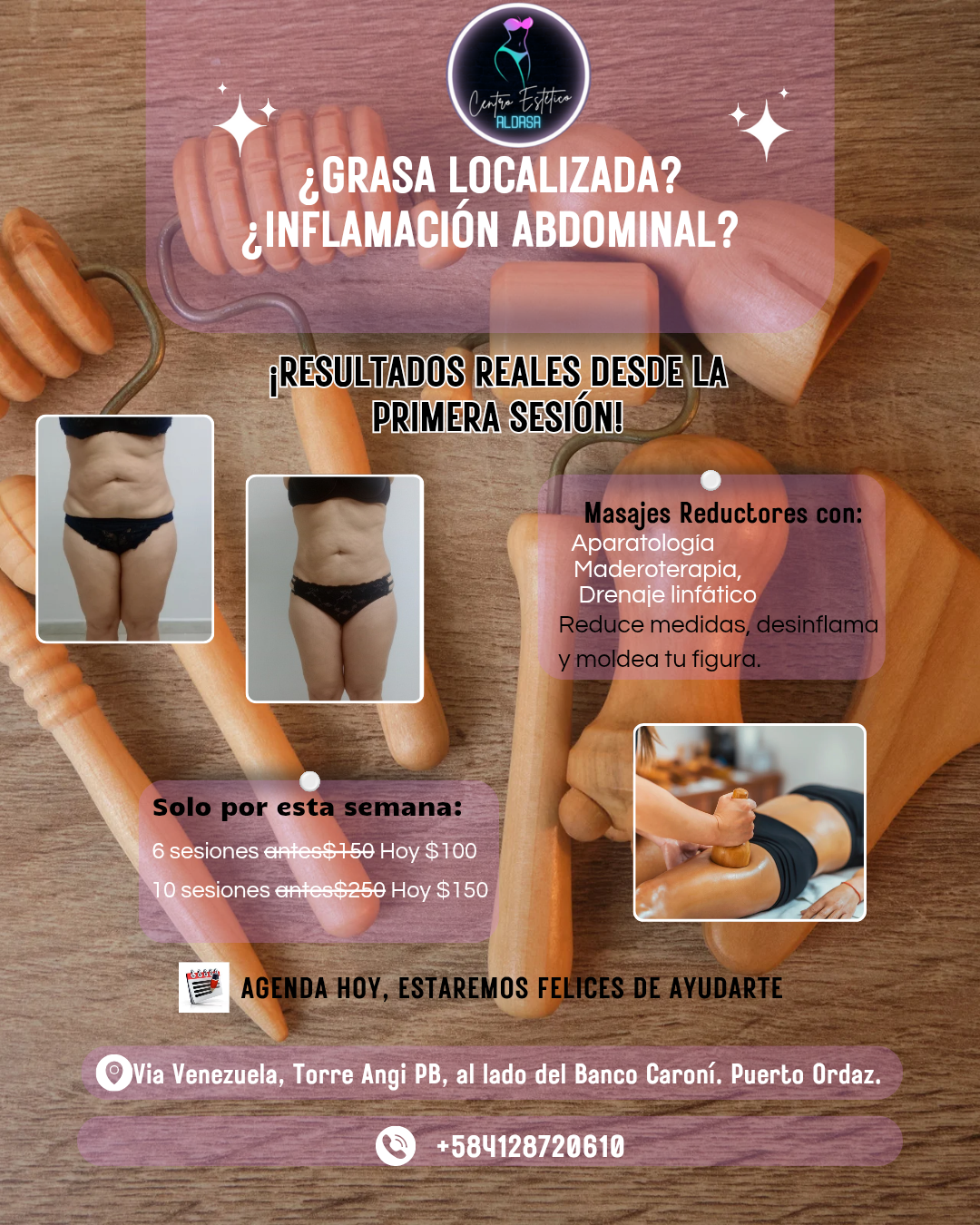 Centro Estético Aldasa Facebook ad from Feb 5, 2026