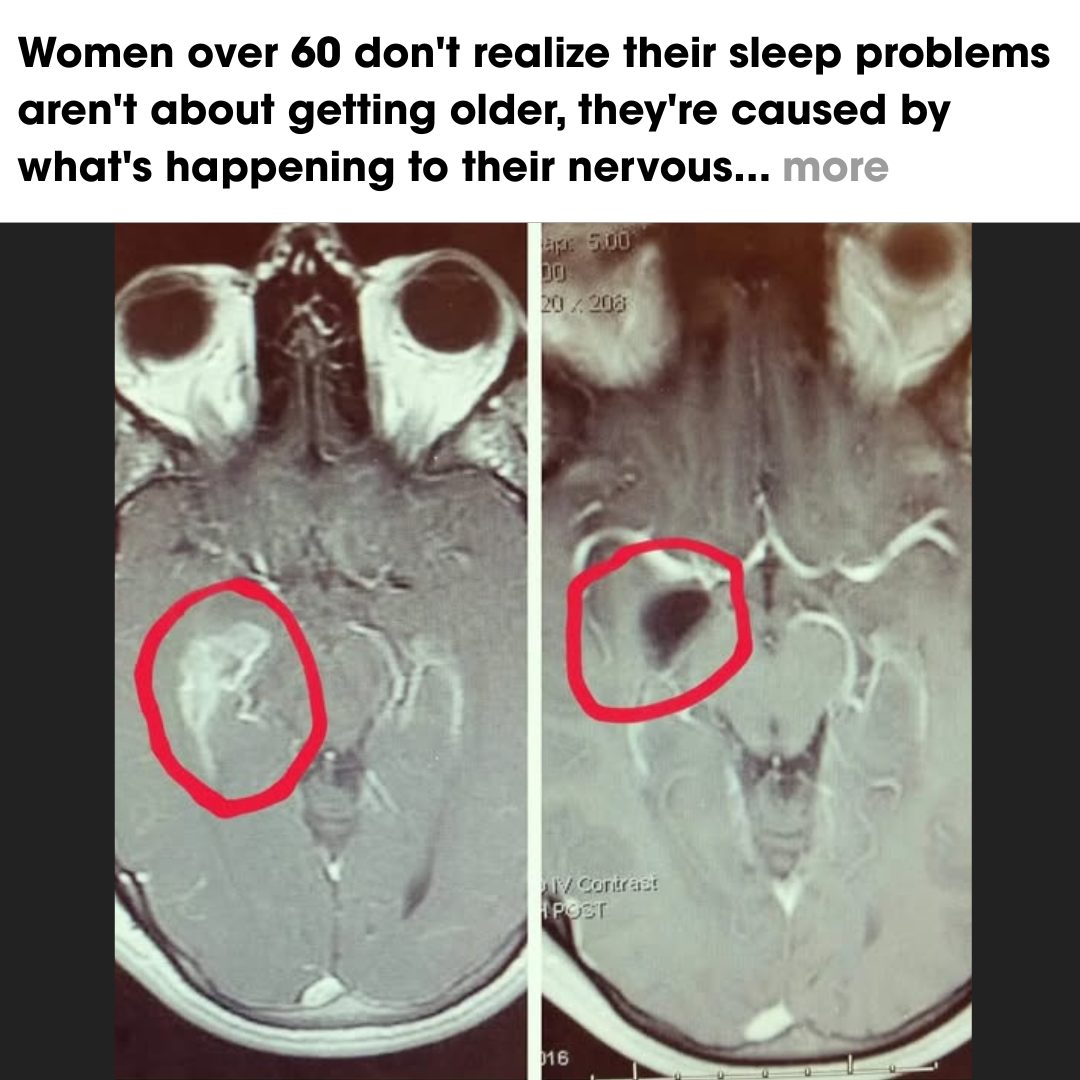 Dr. James Harris - Sleep Specialist Facebook ad