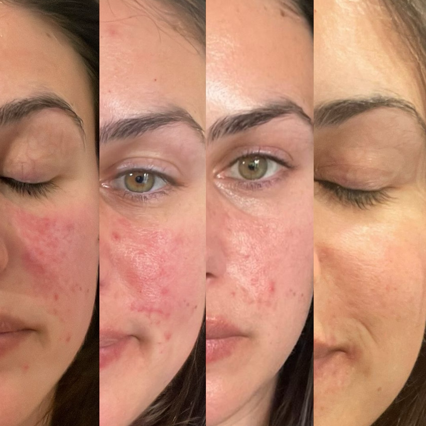 Signature Skin Facebook ad