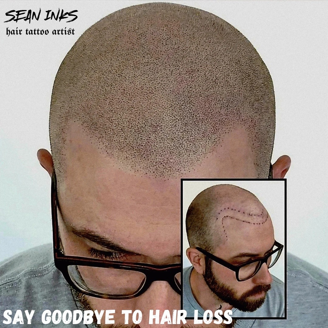 Hair Loss Solution SMP by Sean Inks Facebook ad: This is the best solution for hair loss.