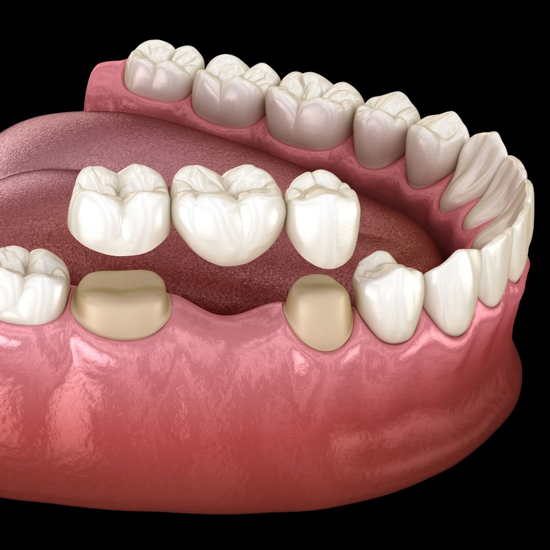 Dentist Near Me Riverside Facebook ad