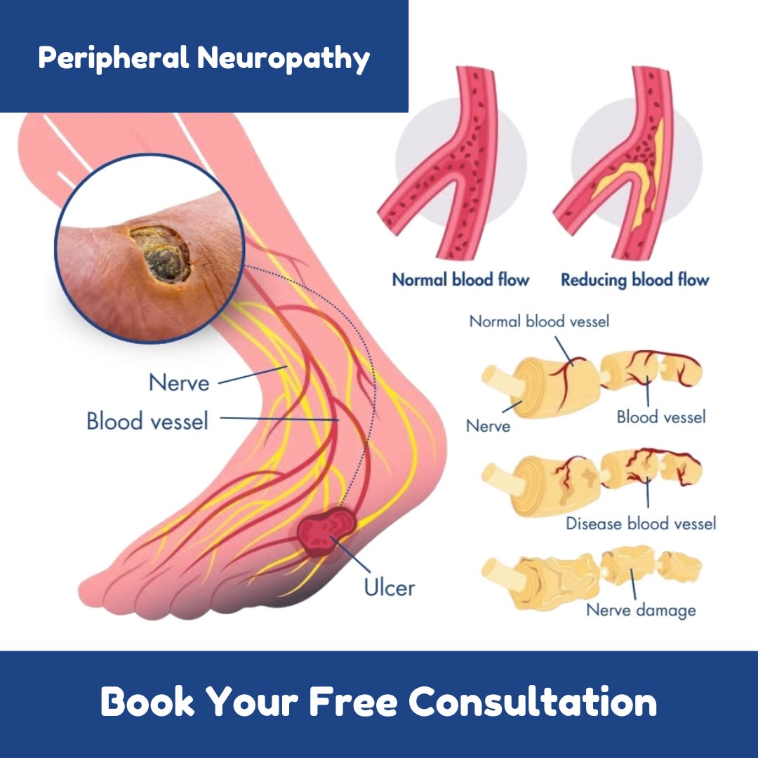 San Marcos Pain Clinic Facebook ad: Get Life-Changing Neuropathy Relief Now