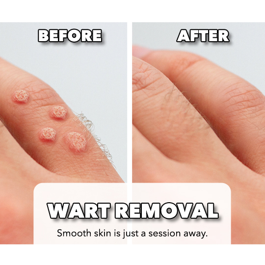 SRM Arnik Skin & Healthcare Clinic Facebook ad