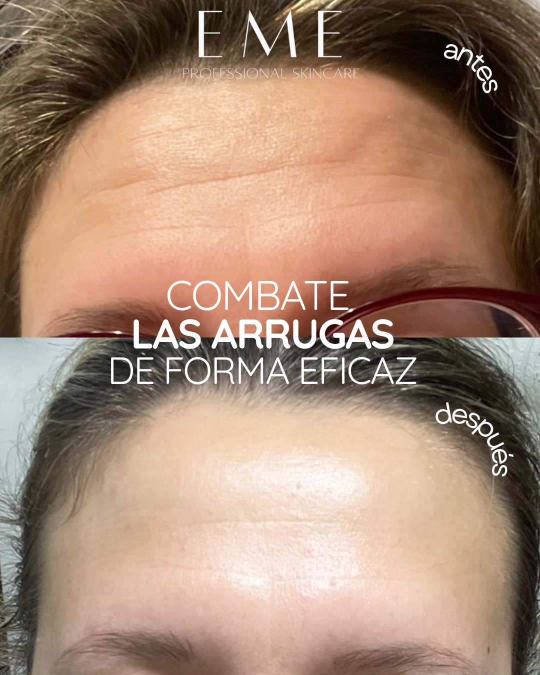 EME Professional Skincare Facebook ad from Apr 28, 2026