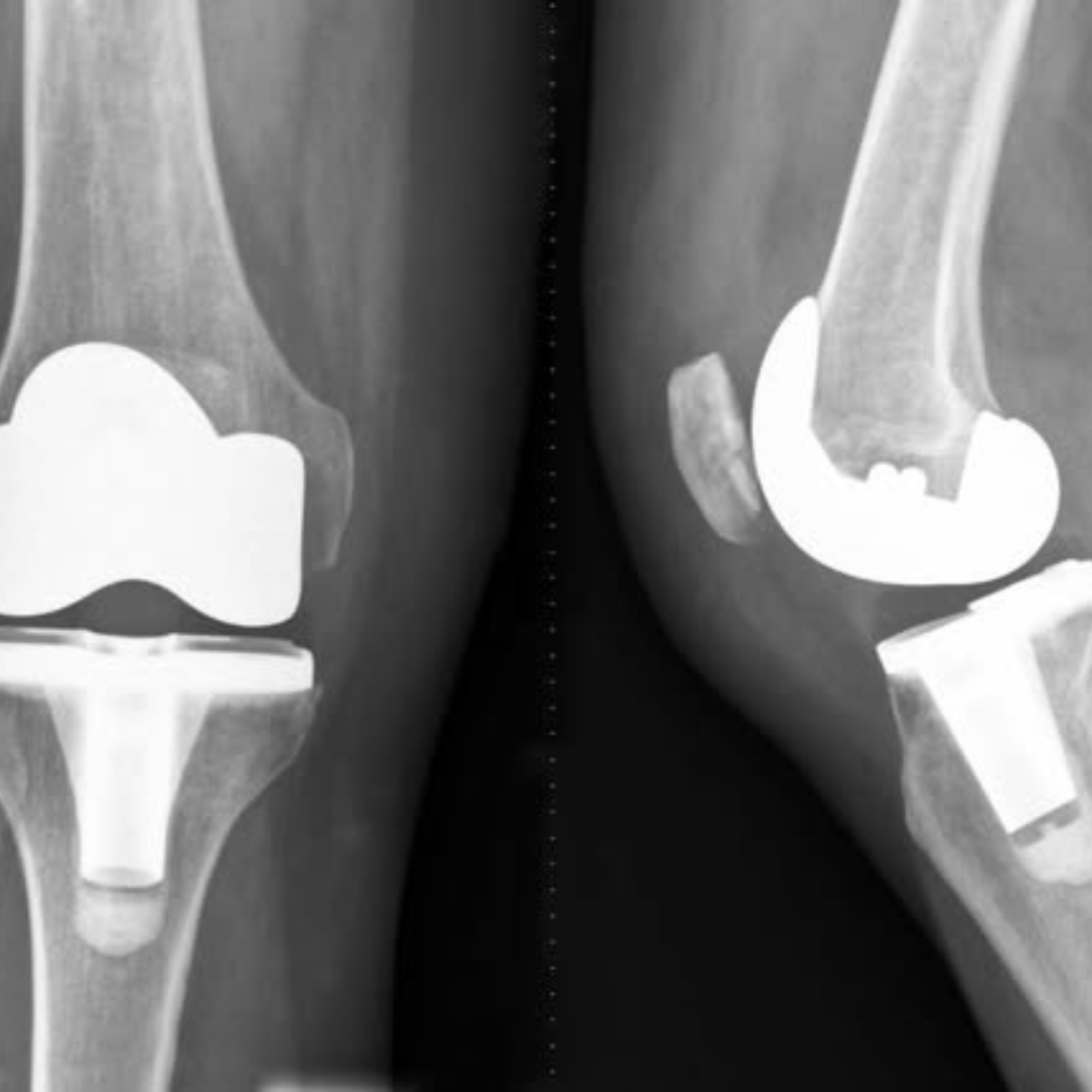 Paige Loren Facebook ad: What Nobody Tells You About Your Knee