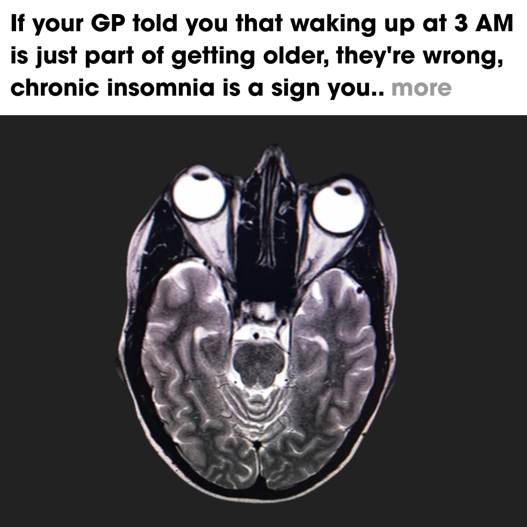 Dr. James Harris - Sleep Specialist Facebook ad