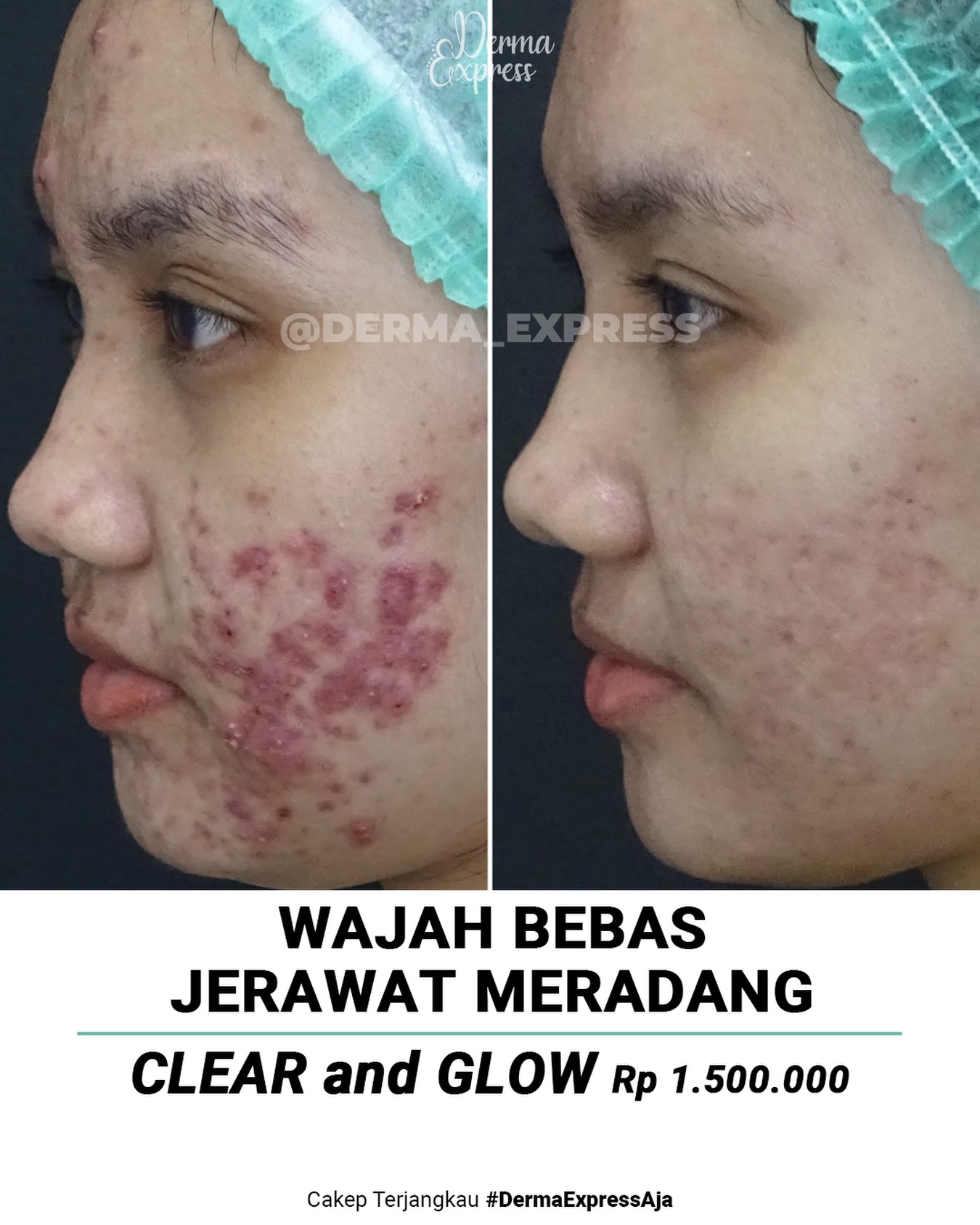 derma_express Facebook ad