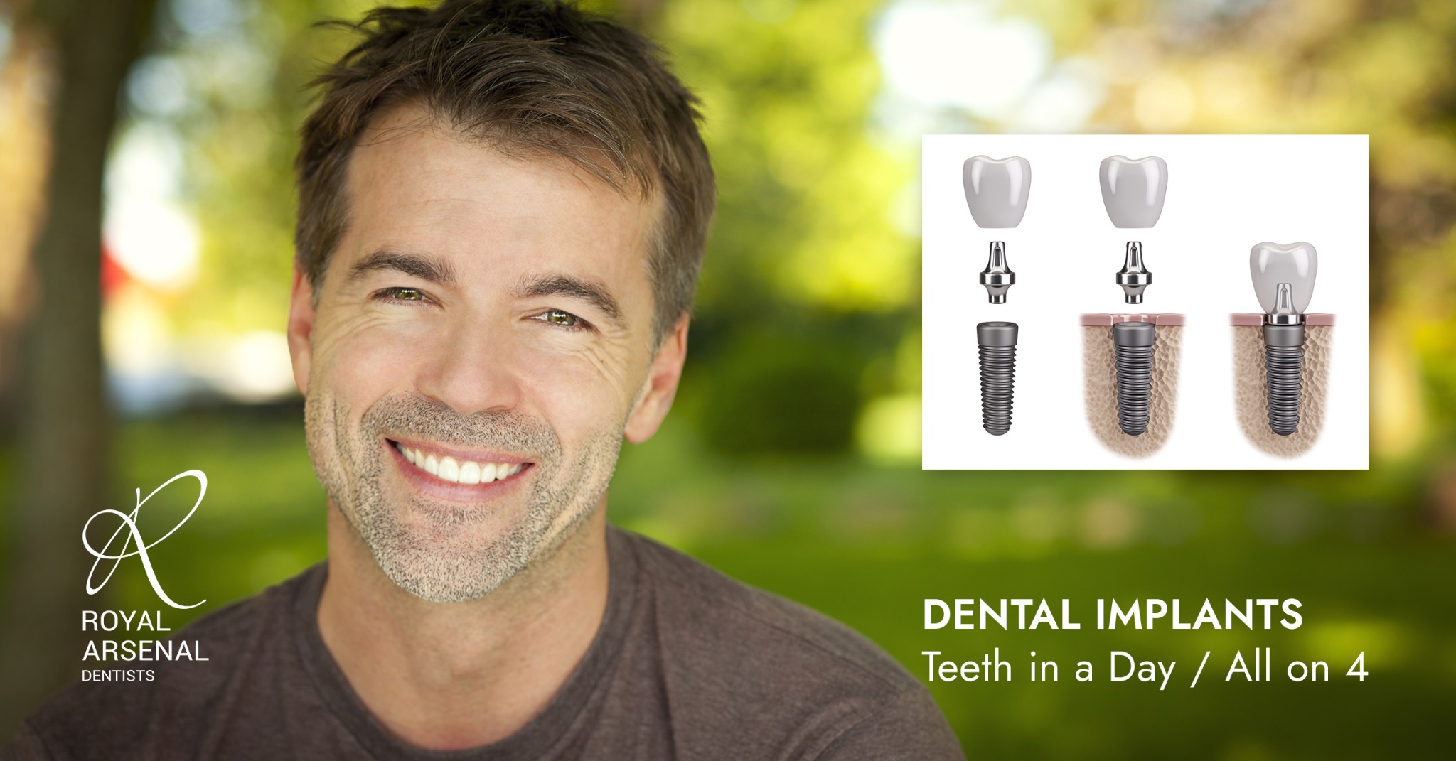 Royal Arsenal Dentists Facebook ad