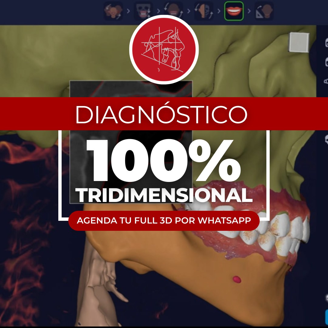 CDO Centro De Diagnóstico en Ortodoncia Facebook ad: El Full 3D reúne tomografía completa, escaneo facial…