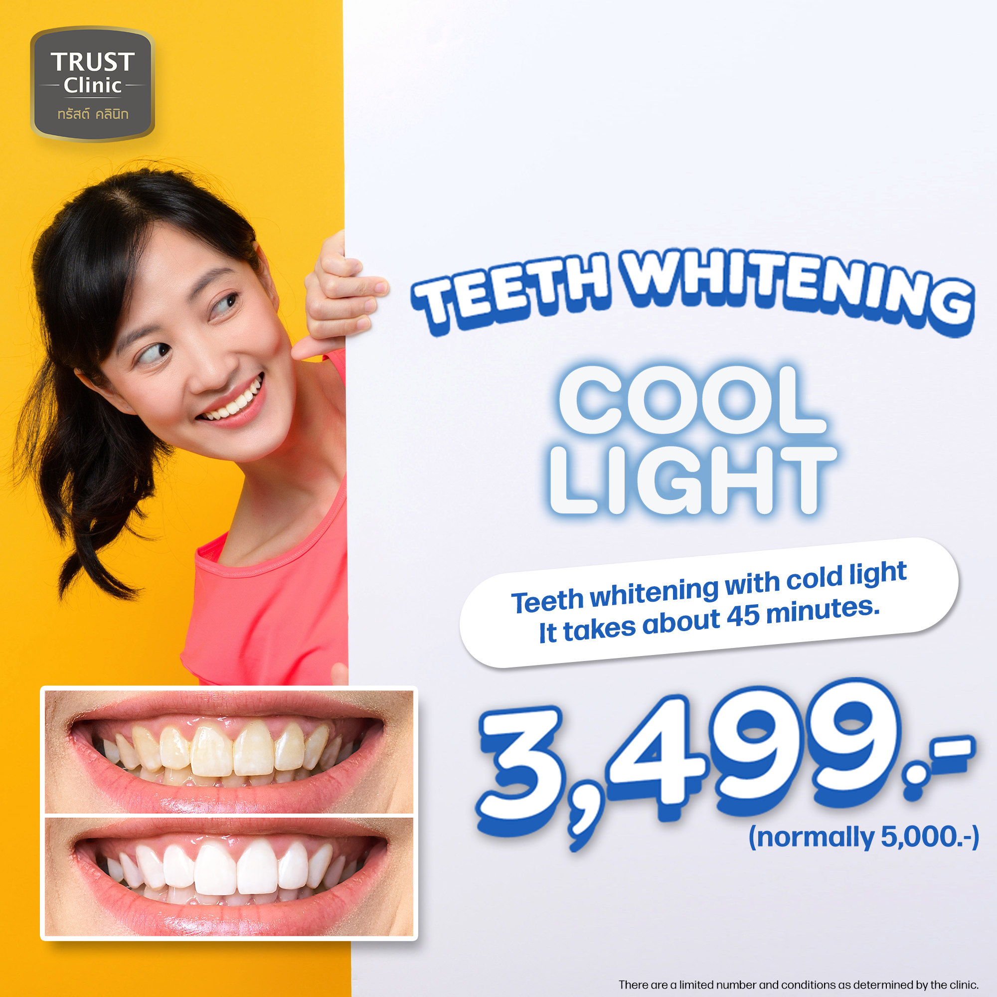 Trust Dental Clinic Facebook ad