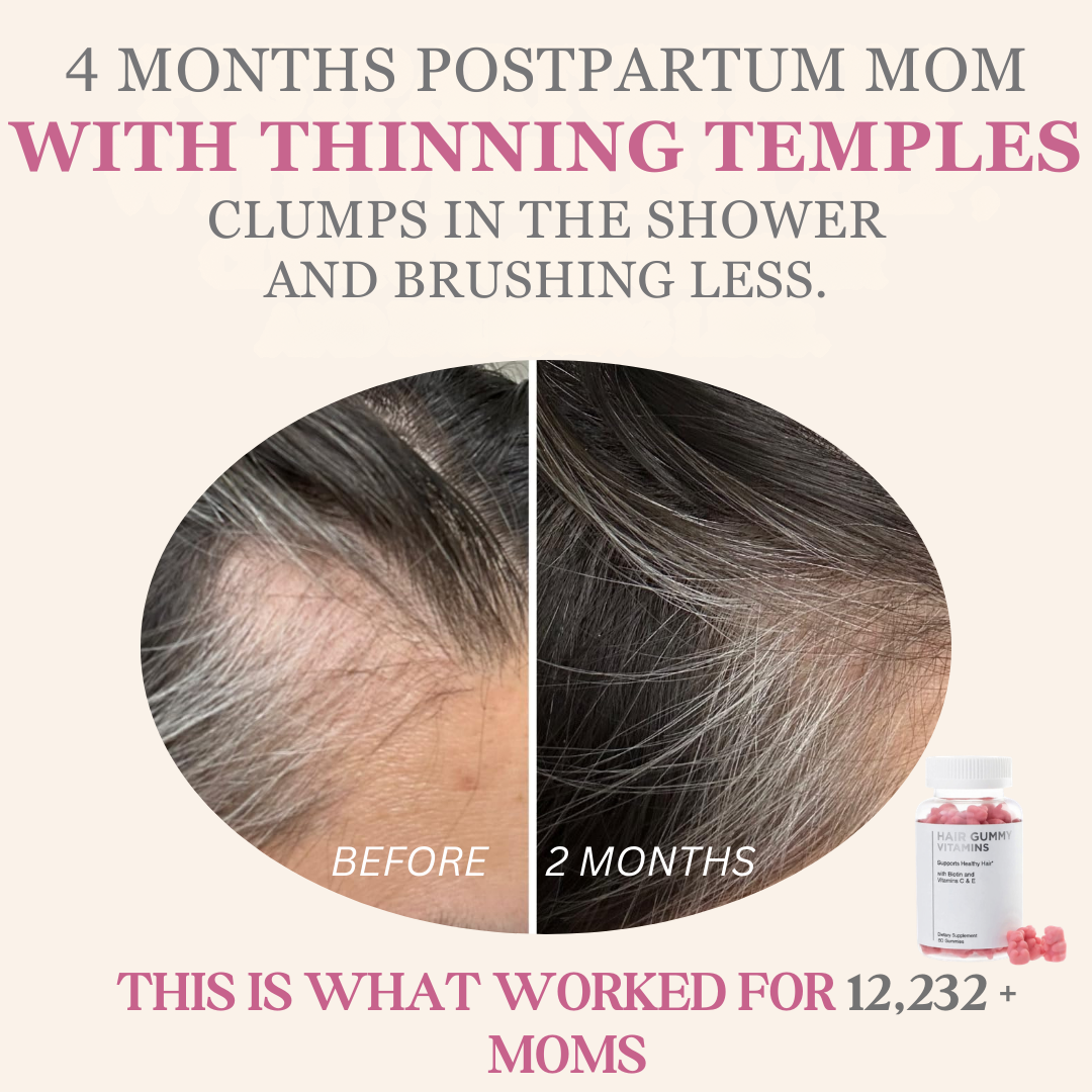 TRY UMMI Facebook ad: Thinning Temples After Baby? You're Not Alone