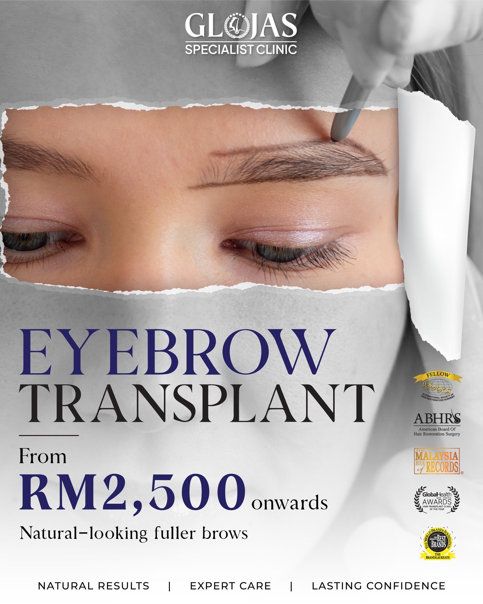 Glojas FUE Hair Transplant Specialist Malaysia Facebook ad: Hair Transplant Malaysia l Pakar Tanam Rambut l…