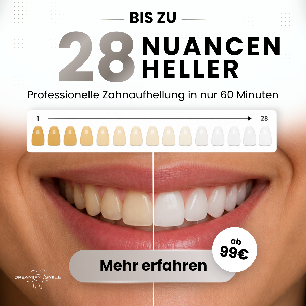 Dreamify Smile Facebook ad: NEU: Weiße Zähne in 60 Minuten. Schmerzfrei…