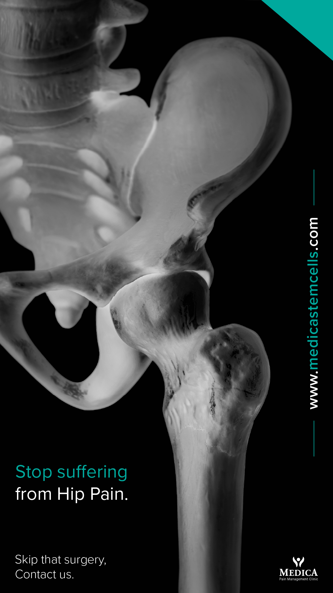 Medica Stem Cells Facebook ad