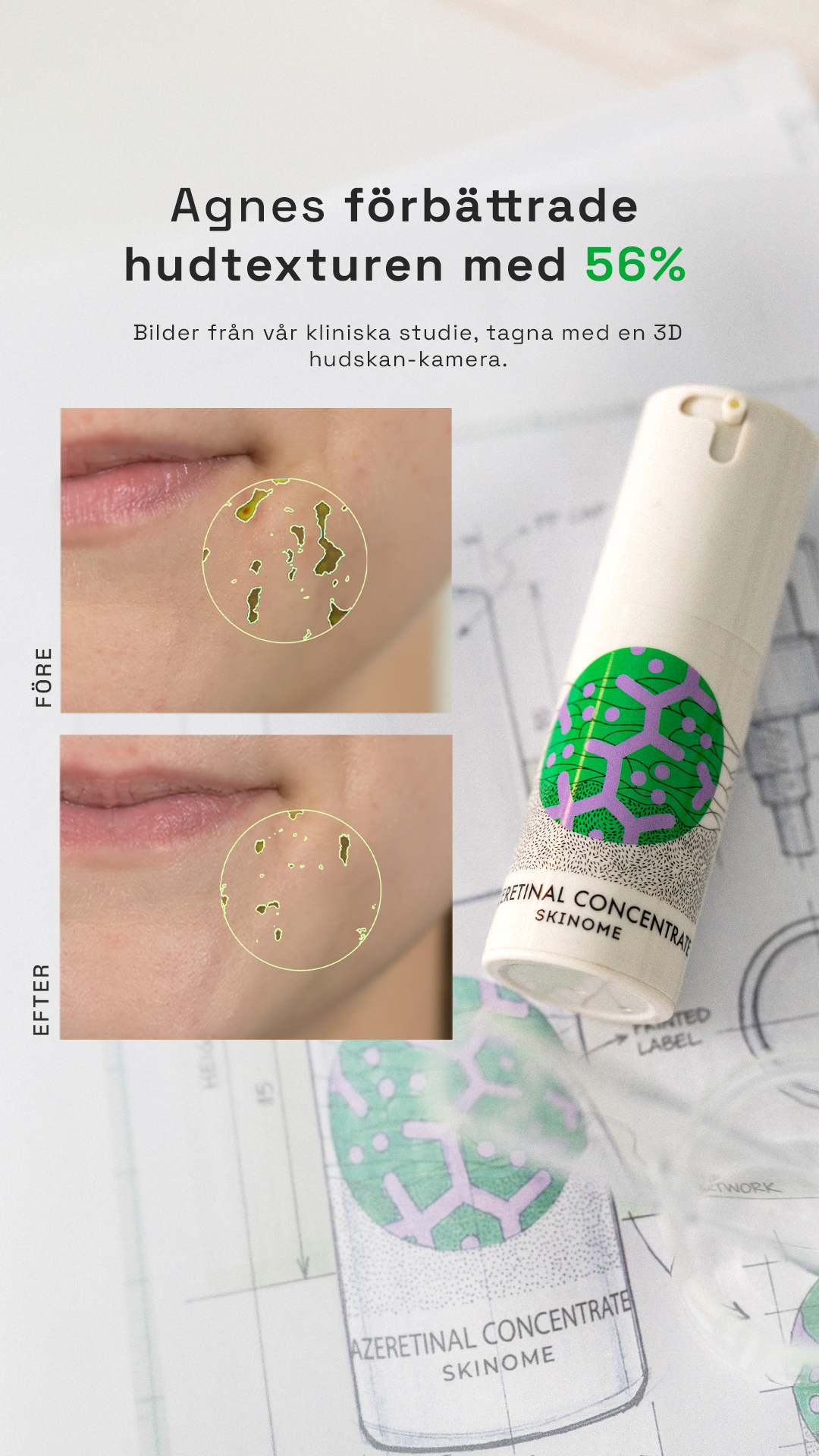 Skinome Facebook ad