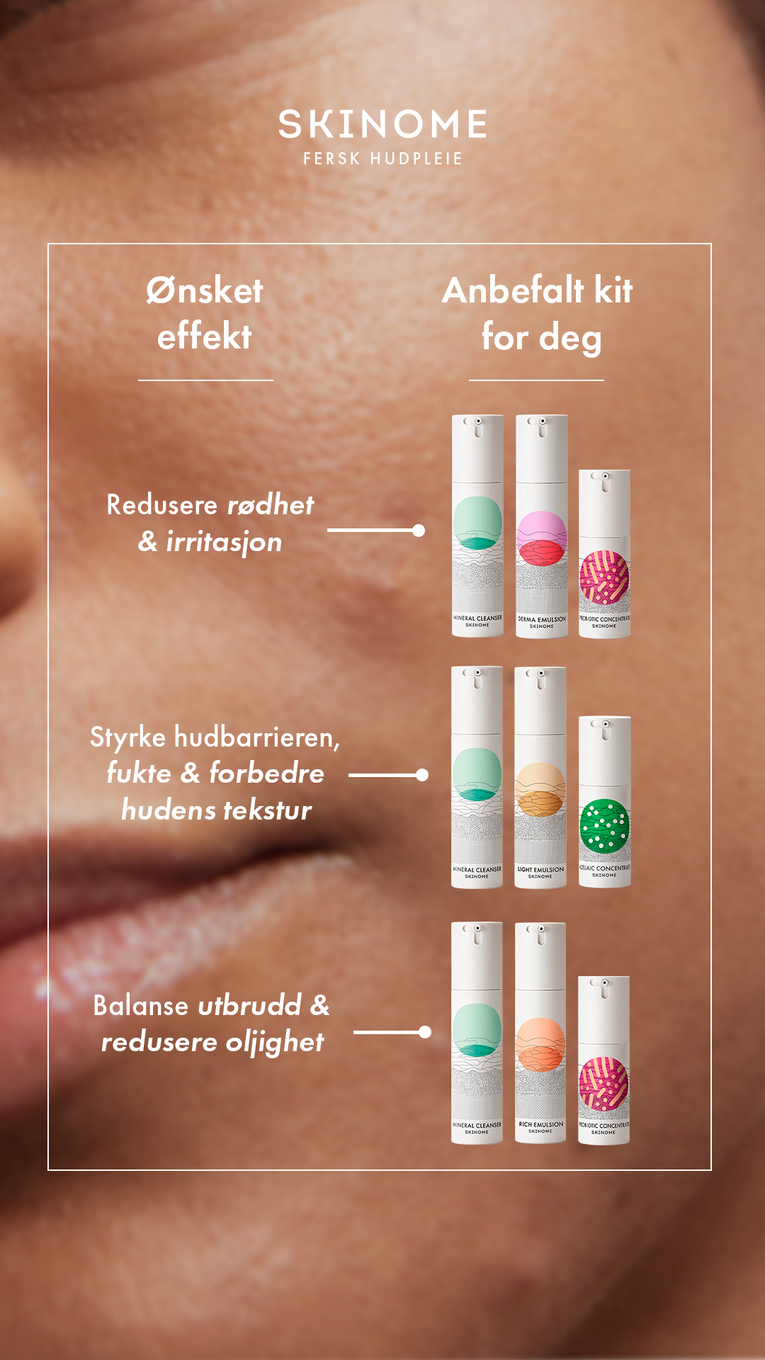 Skinome Facebook ad