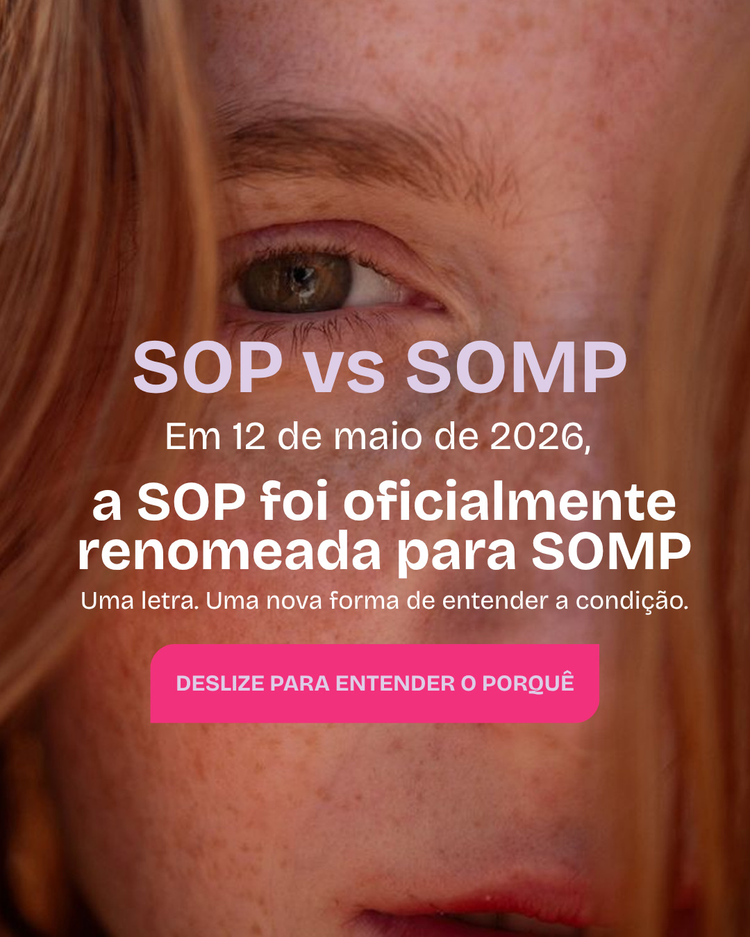 Ovacare - Suplementos para SOP e Endometriose Facebook ad: A Síndrome do Ovário Policístico (SOP) mudou de…