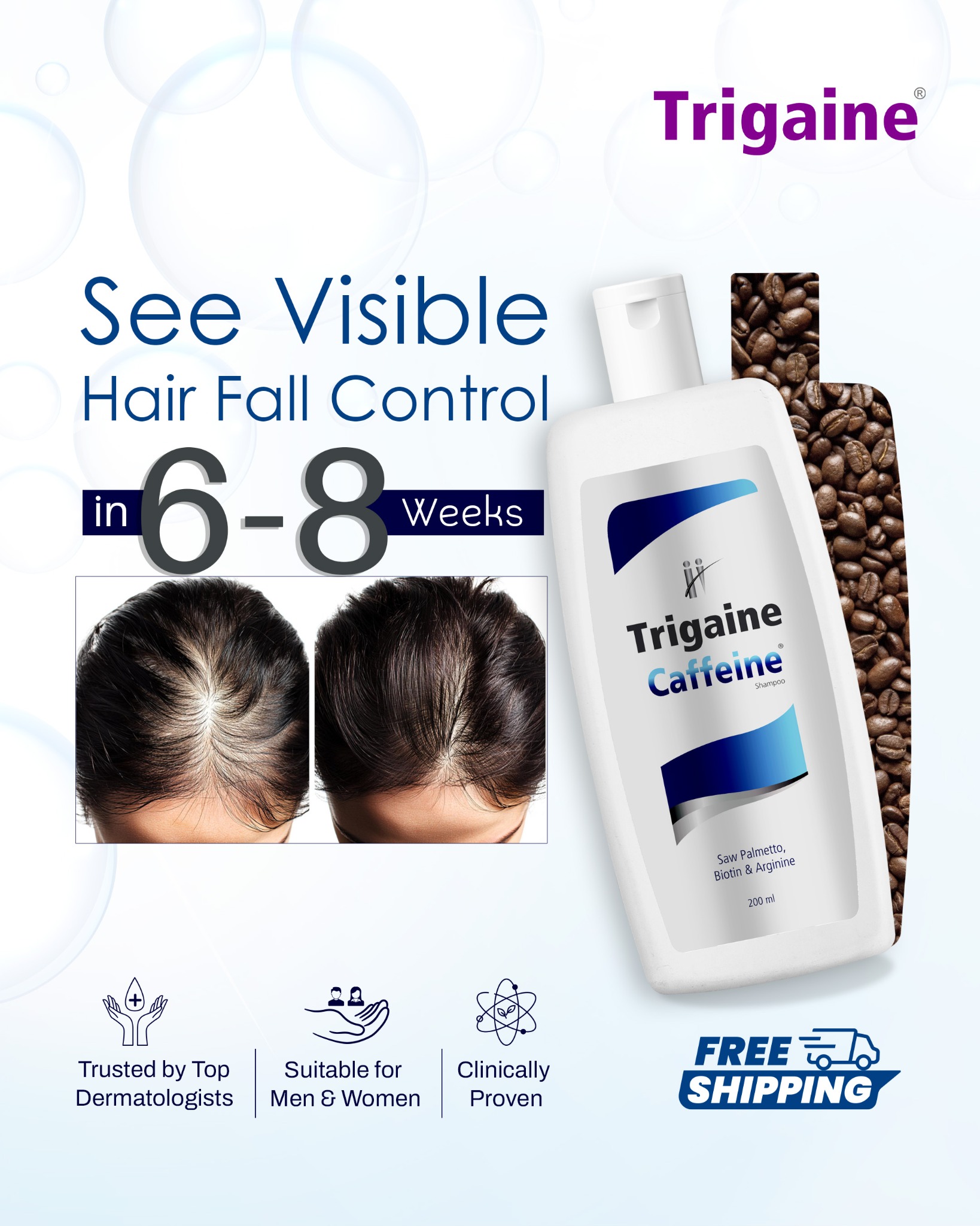 Trigaine By Apple Therapeutics Facebook ad: Dermat-Recommended Hairfall Solution