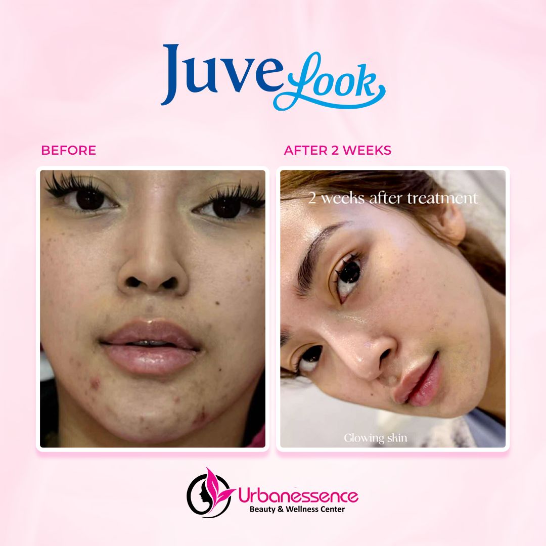 Urbanessence Beauty & Wellness Facebook ad: It's not magic, it's JuveLook!