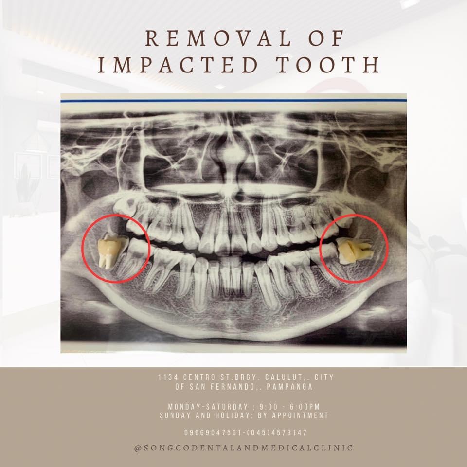 Songco Dental and Medical Clinic Facebook ad
