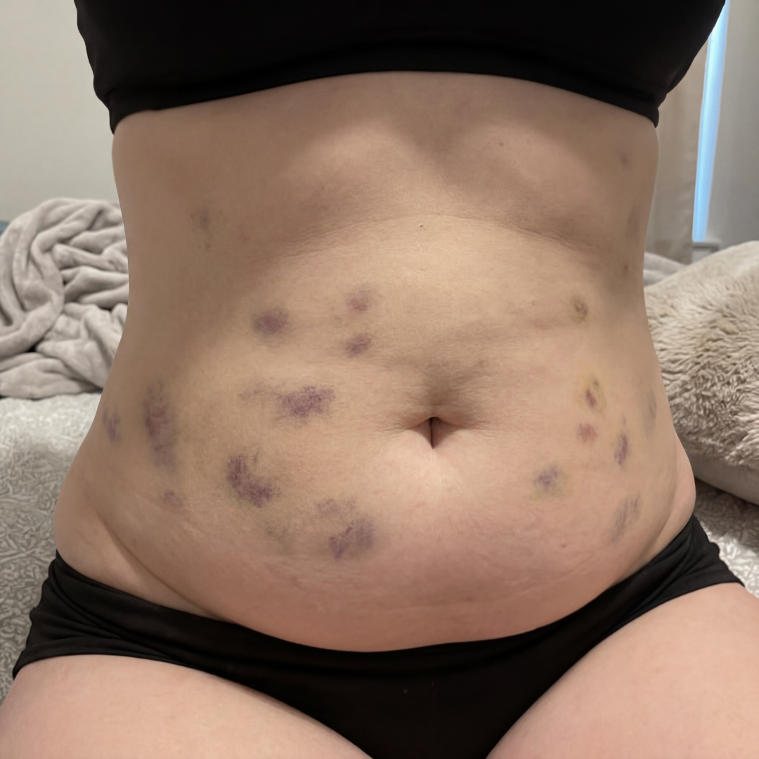 Hypnari: Weight-Loss Hypnotherapy Facebook ad