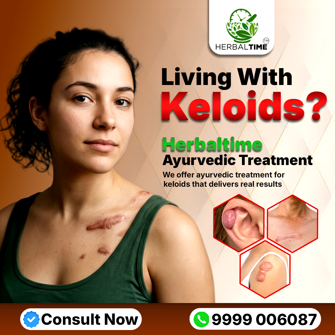 Herbal Time Pvt. Ltd. Facebook ad: Talk to Expert 8595524933
