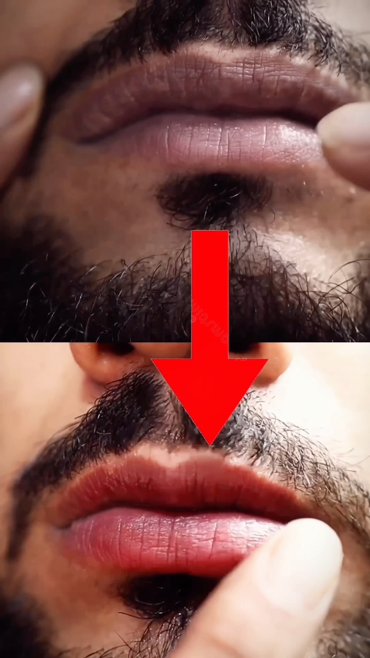 Dermatouch Facebook ad: Comment LIP To get the link in your…