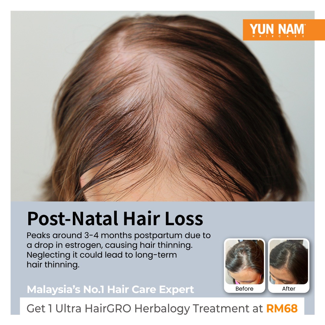 Yun Nam Hair Care Malaysia Facebook ad