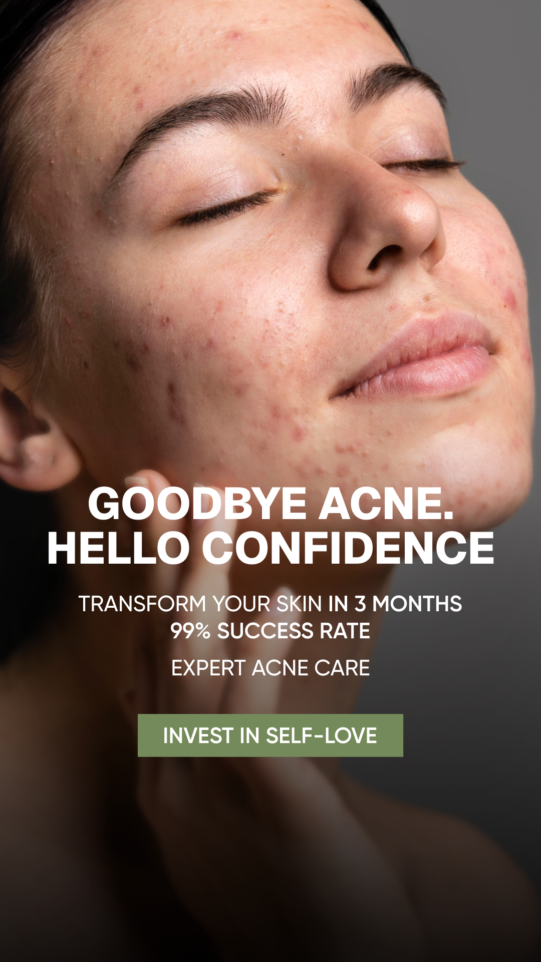 Acne Clinic NYC: Acne, Pigmentation, and Scars Treatment Facebook ad
