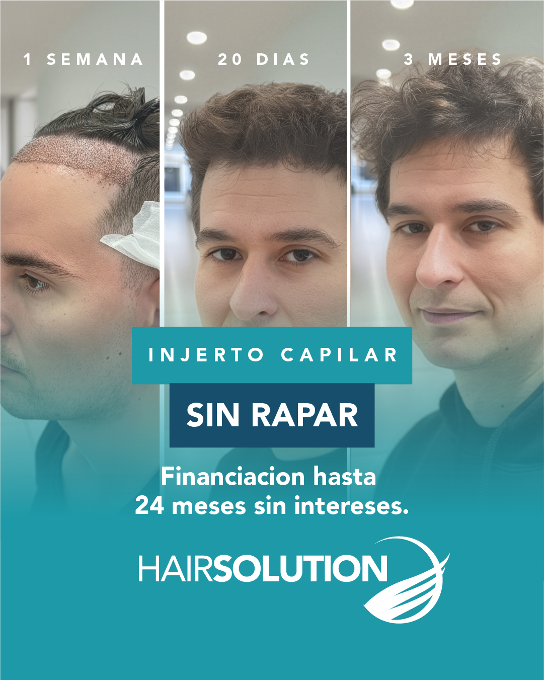 Hair Solution Facebook ad
