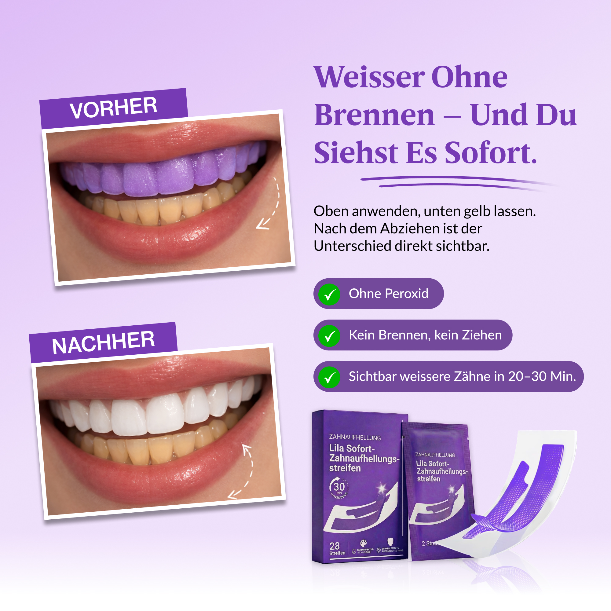 White Smile Journal Facebook ad: Weissere Zähne in 30 Minuten