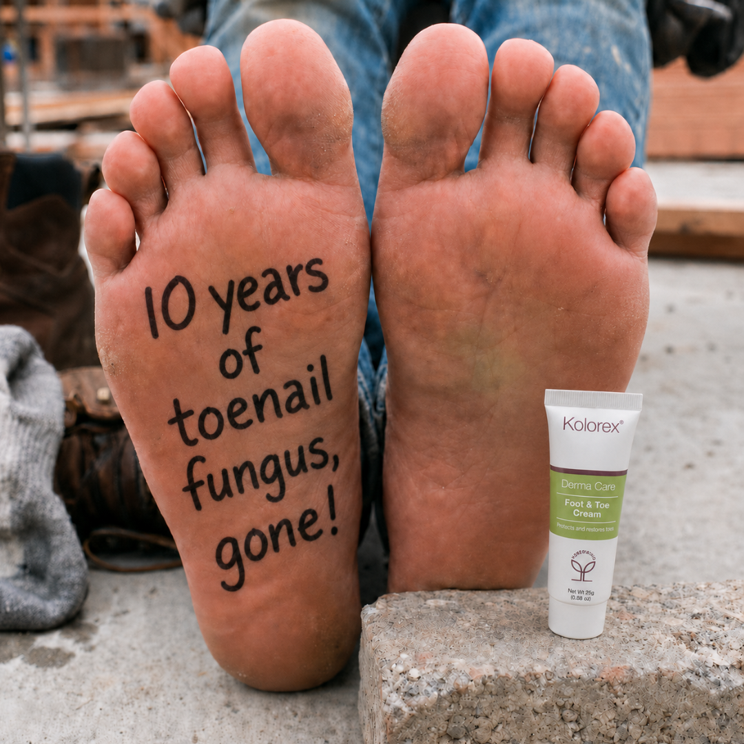Kolorex Facebook ad: 10 years of toenail fungus - gone!