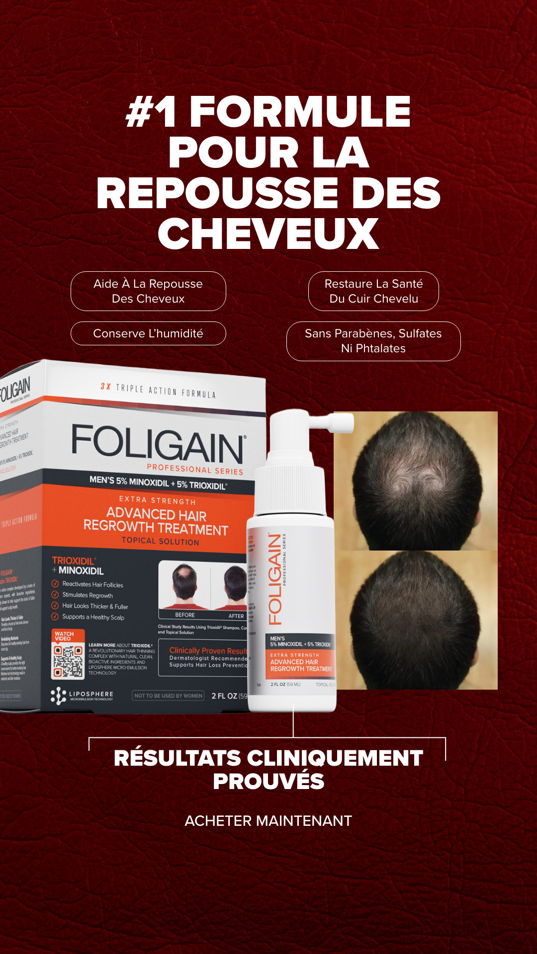 FOLIGAIN Facebook ad
