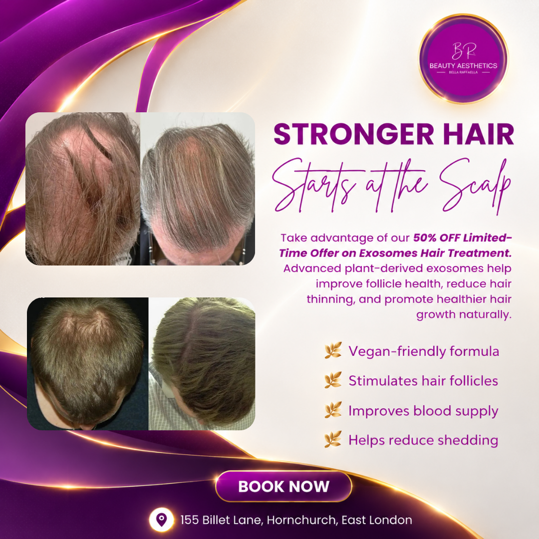 BR Beauty Aesthetics Facebook ad: 50% OFF | Advanced Hair Exosome Therapy