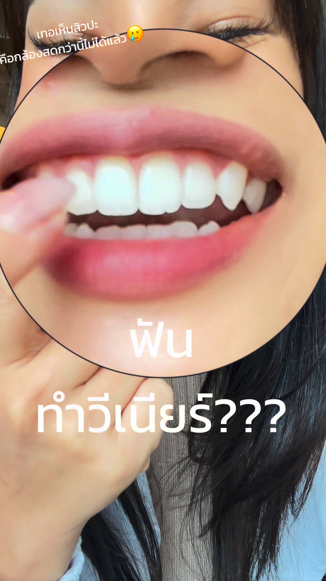 LINEE professional teeth whitening Facebook ad: ยิ้มสวยสั่งได้ด้วยยาสีฟันม่วงสุดฮิต!