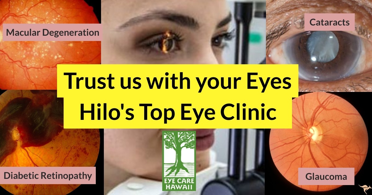 Eye Care Hawaii Facebook ad: Eye Care & Eye Exams in Hilo, Hawaii