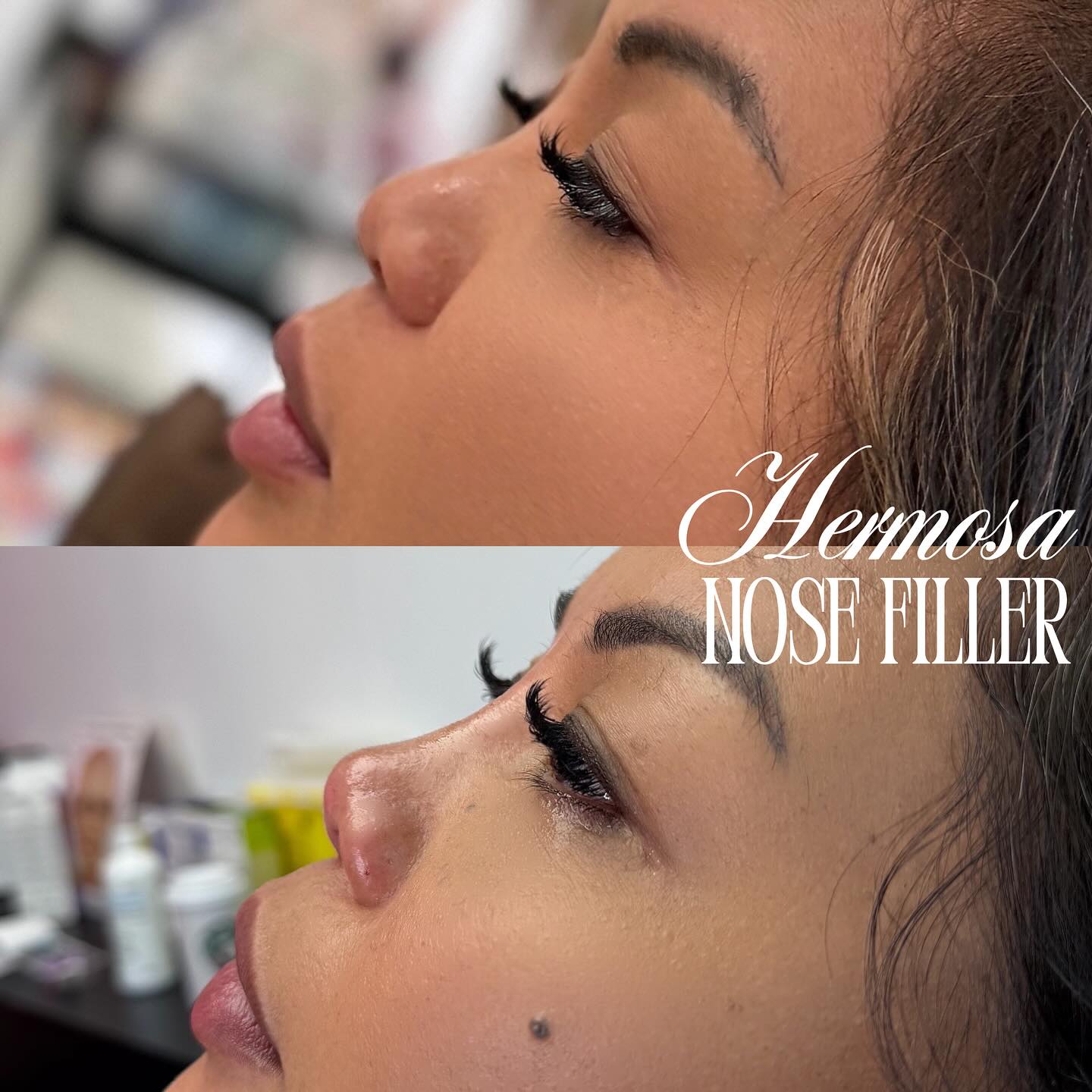 H e r m o s a S t u d i o Facebook ad: TINKER BELL NOSE FILLER BY NURSE JOAN