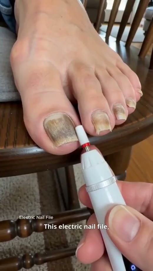 Ooyot Facebook ad: Elektrisk nagelfil, mångsidig användning för nagelsvamp…