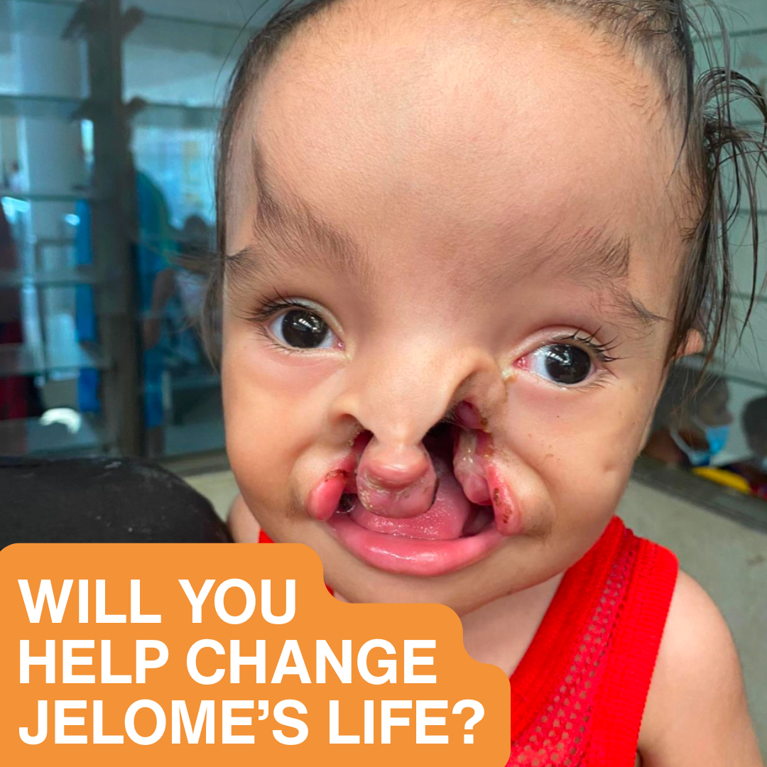 Children First Foundation Facebook ad: Help him now