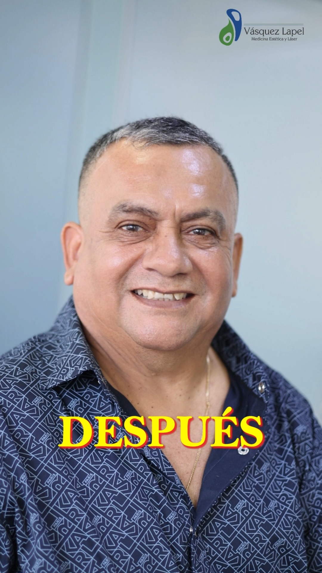 Vásquez Lapel Medicina Estética y Láser Facebook ad: ¡Adiós arrugas y manchas, hola piel radiante!