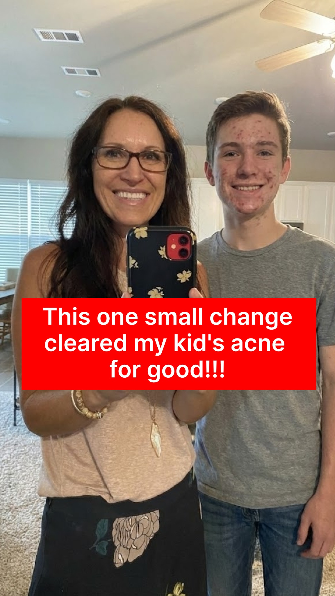 Anne's Skincare Blog Facebook ad