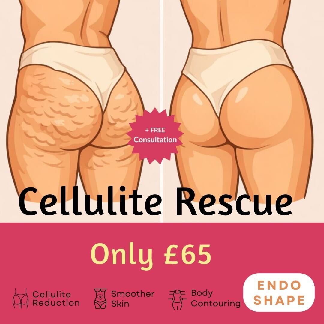 Suraya Beauty Corner Facebook ad: Cellulite rescue - Now Just £65