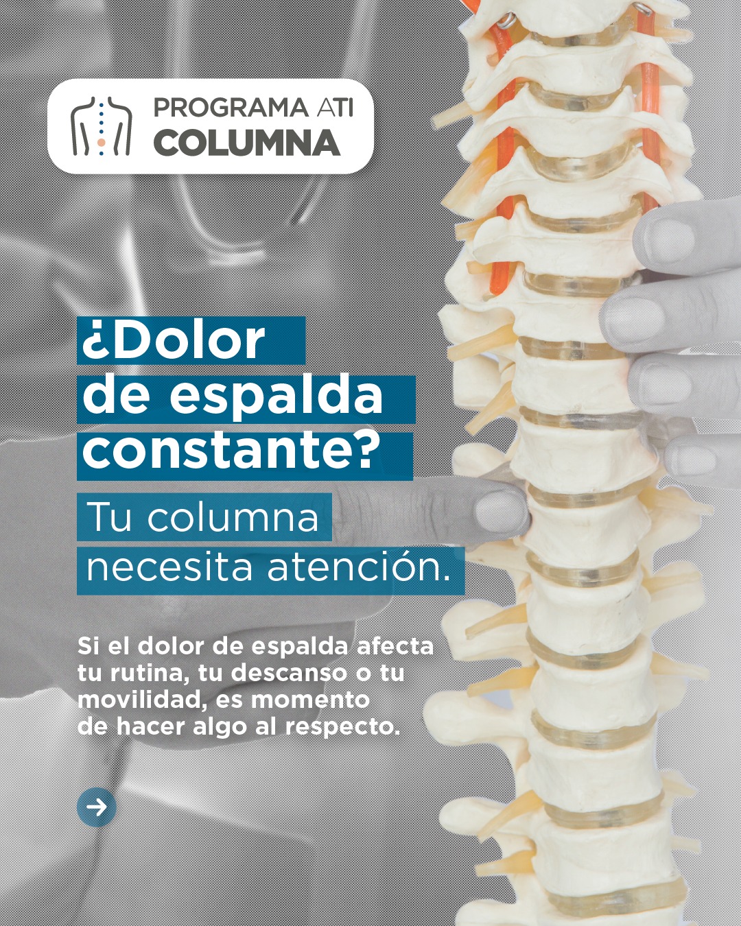 Conci·Carpinella Facebook ad: ¿Dolor de espalda?