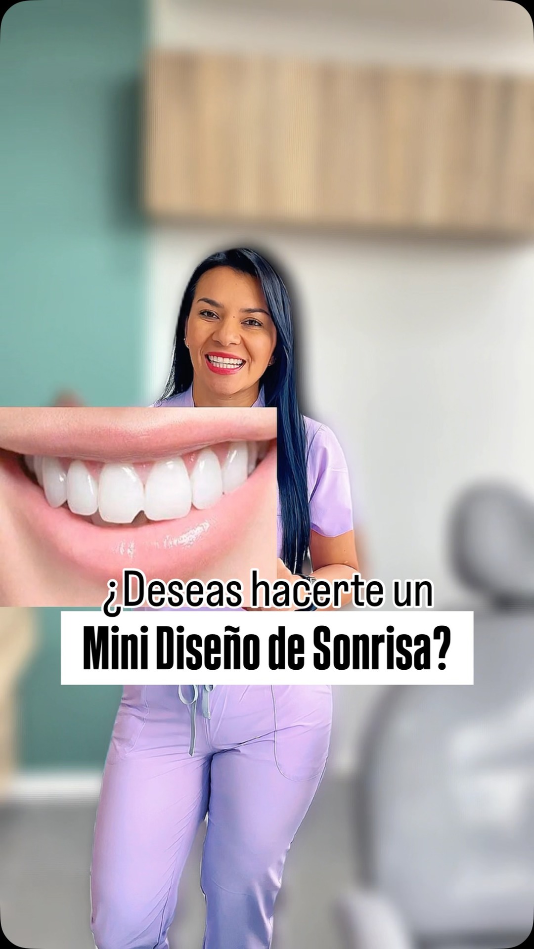 Serina Salud Dental Facebook ad: ¿Tus dientes están desgastados, partidos o tienes espacios…