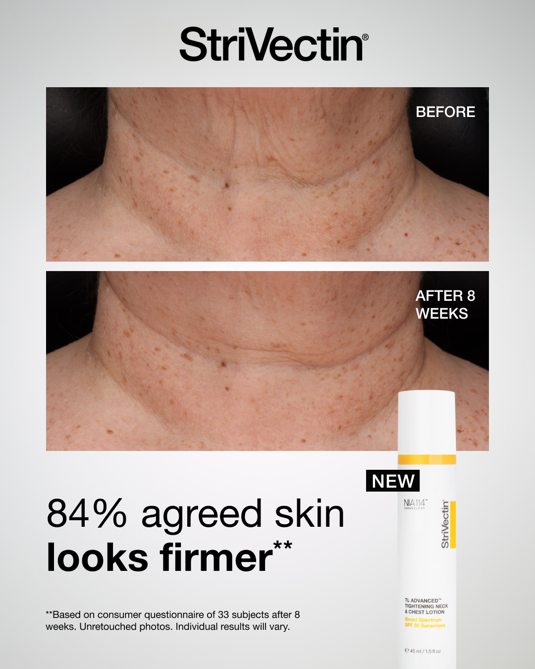 StriVectin Facebook ad