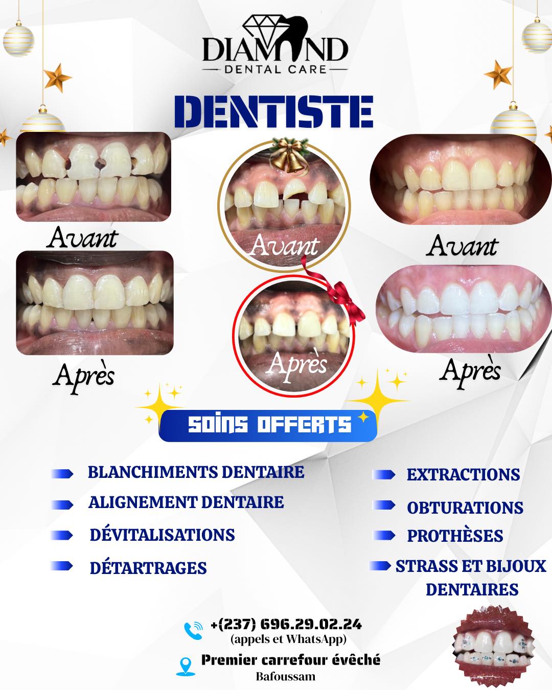Diamond Dental care Facebook ad: OFFRE SPÉCIALE DÉBUT D’ANNÉE, VOTRE SANTÉ BUCCO-DENTAIRE…