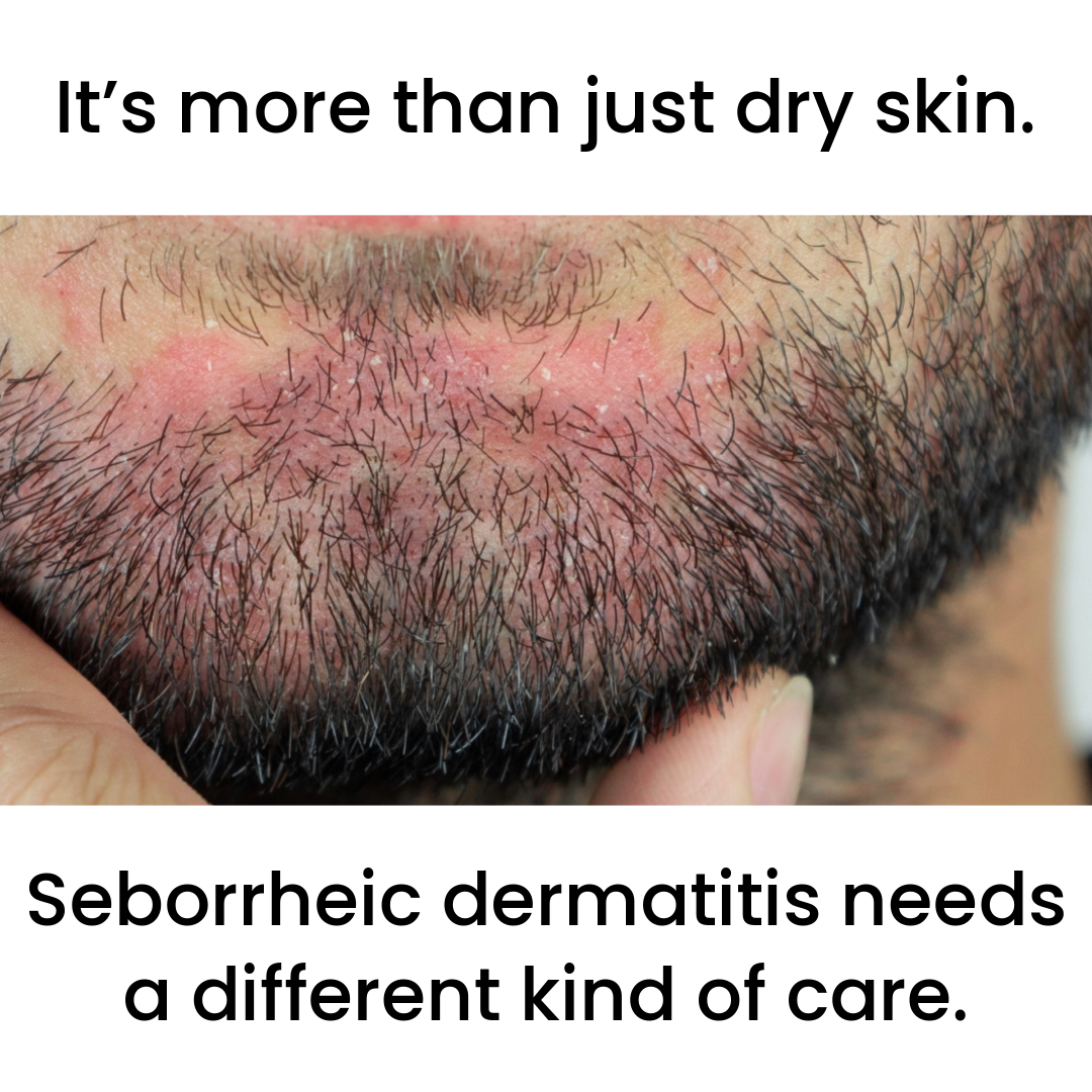 Seb Skincare Facebook ad