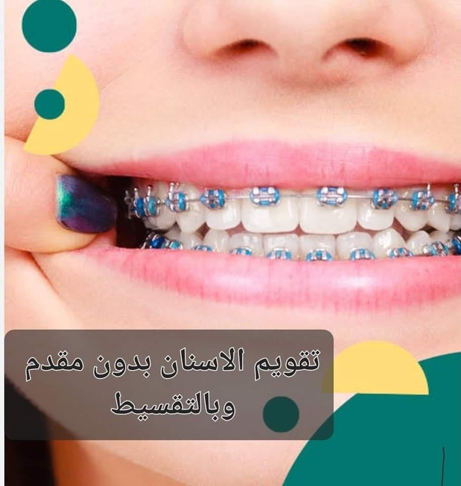 smile design تصميم الابتسامة Facebook ad: عايز تعمل تقويم أسنان بس متردد!